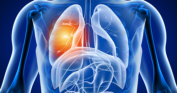 Akciğer Zarı Kanserinde Yaşam Süresi Ne Kadar?