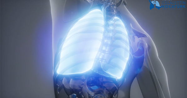 Akciğer Zarı Kanseri (Mezotelyoma) Nedir?