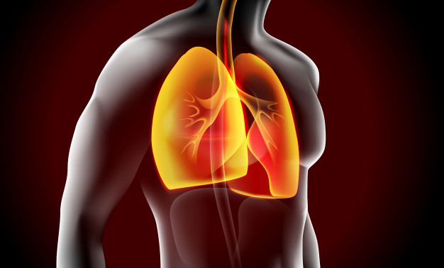 Akciğer Kanseri Belirtileri Nelerdir Ve Tedavisi 